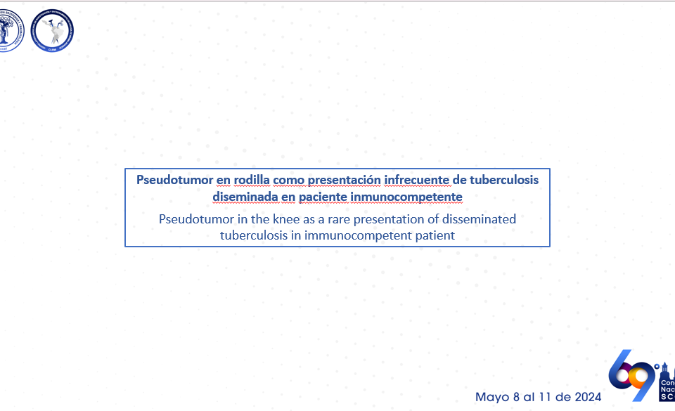 EP131 Pseudotumor en rodilla como presentación infrecuente de tuberculosis diseminada en paciente inmunocompetente