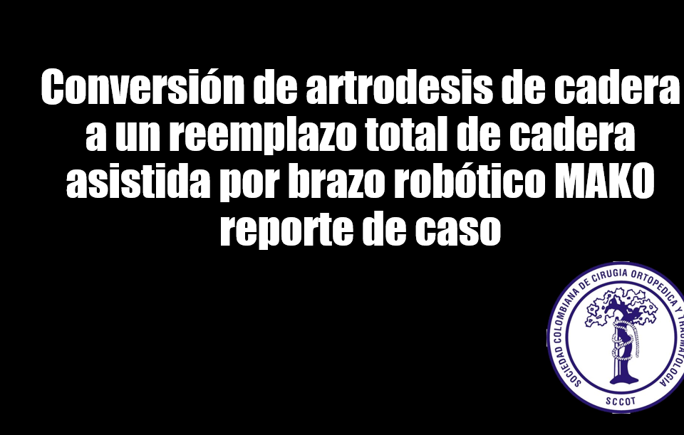EP140 Conversión de artrodesis de cadera a un reemplazo total de cadera asistida por brazo robótico MAKO reporte de caso